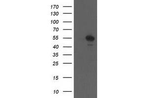 Western Blotting (WB) image for anti-Cerebral Cavernous Malformation 2 (CCM2) antibody (ABIN1497135) (CCM2 抗体)