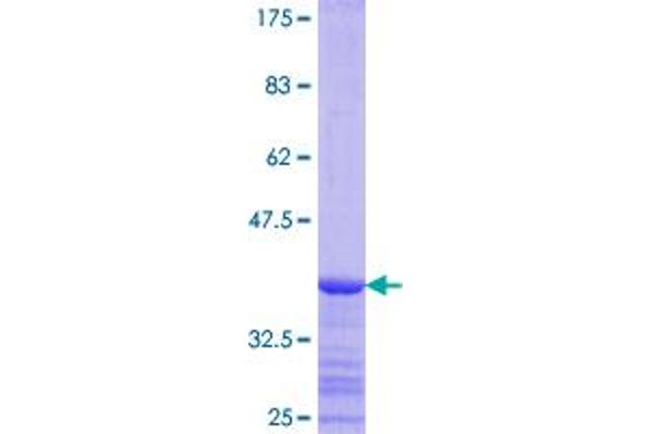 ACSL4 Protein (AA 581-670) (GST tag)