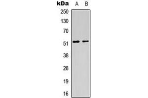 Western blot analysis of CHRM1 expression in HeLa (A), mouse brain (B) whole cell lysates. (CHRM1 抗体  (Center))