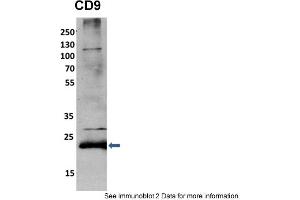 Sample Type: mouse fibroblast lusate (10ug)Primary Dilution: 1:2000 (1% BSA)Secondary Dilution: 1:2000 (5% milk)Image Submitted By: Anonymous researcher . (CD9 抗体  (N-Term))