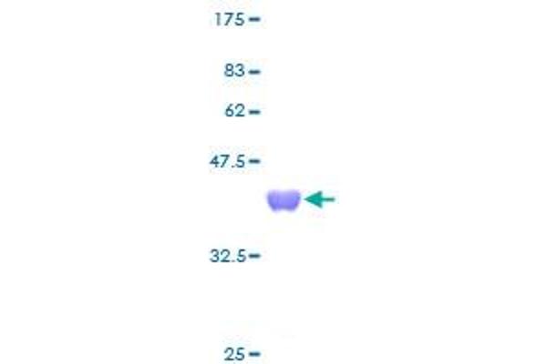 TXN Protein (AA 1-105) (GST tag)