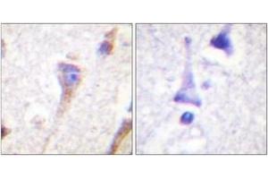 Immunohistochemistry (IHC) image for anti-Protein Kinase D1 (PRKD1) (AA 429-478) antibody (ABIN2888772) (PKC mu 抗体  (AA 429-478))