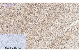 Immunohistochemical analysis of paraffin-embedded human uterus tissue. (Cyclin A 抗体  (AA 190-270))