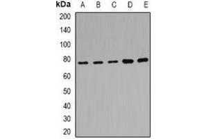 Western blot analysis of POR expression in Hela (A), MCF7 (B), mouse liver (C), mouse kidney (D), rat brain (E) whole cell lysates. (POR 抗体)