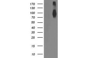 Western Blotting (WB) image for anti-Fibroblast Growth Factor Receptor 2 (FGFR2) antibody (ABIN1498250) (FGFR2 抗体)