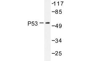 Image no. 1 for anti-Tumor Protein P53 (TP53) antibody (ABIN272049) (p53 抗体)