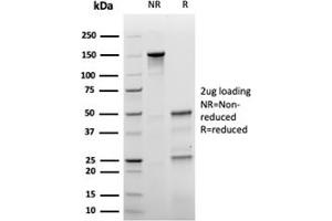 SDS-PAGE Analysis Purified p27 Recombinant Mouse Monoclonal Antibody (rKIP1/1356). (Recombinant CDKN1B 抗体)