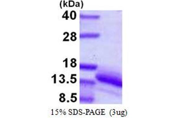 VOPP1 Protein (AA 82-172) (His tag)