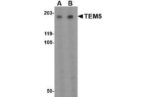 Image no. 1 for anti-G Protein-Coupled Receptor 124 (GPR124) (Internal Region) antibody (ABIN1493615) (GPR124 抗体  (Internal Region))