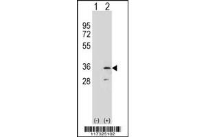 Western blot analysis of RPA2 using rabbit polyclonal RPA2 Antibody using 293 cell lysates (2 ug/lane) either nontransfected (Lane 1) or transiently transfected (Lane 2) with the RPA2 gene. (RPA2 抗体  (N-Term))