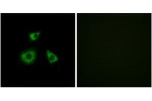 Immunofluorescence analysis of HuvEc cells, using MRPL52 Antibody. (MRPL52 抗体  (AA 71-120))