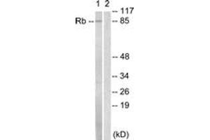 Western Blotting (WB) image for anti-Retinoblastoma Protein (Rb Protein) (AA 771-820) antibody (ABIN2888773) (Retinoblastoma Protein (Rb) 抗体  (AA 771-820))