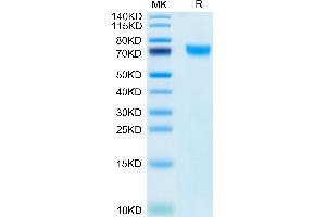 Phospholipase D4 Protein (PLD4) (AA 52-506) (His tag)