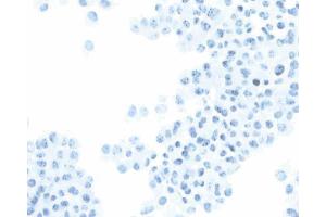 Immunohistochemical staining of SV40 large T, small t antigen. (SV40 Large T and Small Ts 抗体)