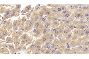 Detection of MCSFR in Mouse Liver Tissue using Polyclonal Antibody to Colony Stimulating Factor Receptor, Macrophage (MCSFR) (CSF1R 抗体  (AA 639-868))