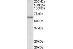 AP31924PU-N LCK antibody staining of Human Thymus lysate at 0. (LCK 抗体  (Internal Region))