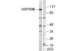Western blot analysis of extracts from Hela cells treated with TNF-α (20ng/ml, 30min), using HSP90B (Ab-254) antibody (#B0013, Line 1 and 2). (HSP90AB1 抗体  (Ser254))