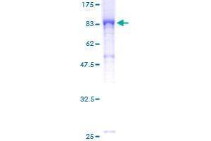 Image no. 1 for Engulfment and Cell Motility 2 (ELMO2) (AA 1-632) protein (GST tag) (ABIN1352710) (ELMO2 Protein (AA 1-632) (GST tag))