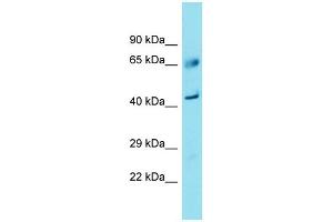 Western Blotting (WB) image for anti-Family with Sequence Similarity 83, Member A (FAM83A) (C-Term) antibody (ABIN2791509) (FAM83A 抗体  (C-Term))