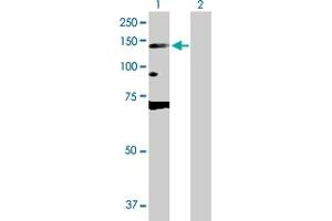 Western Blot analysis of DNMT3A expression in transfected 293T cell line by DNMT3A MaxPab polyclonal antibody. (DNMT3A 抗体  (AA 1-912))