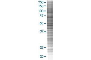 RCHY1 transfected lysate. (RCHY1 293T Cell Transient Overexpression Lysate(Denatured))