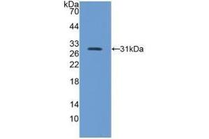 Detection of Recombinant ITGb5, Mouse using Polyclonal Antibody to Integrin Beta 5 (ITGb5) (Integrin beta 5 抗体  (AA 136-378))