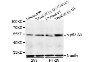 Western blot analysis of extracts of 293 and HT-29 cells, using Phospho-p53-S9 antibody. (p53 抗体  (pSer9))