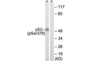 Western blot analysis of extracts from Jurkat cells treated with UV 15', using p53 (Phospho-Ser378) Antibody. (p53 抗体  (pSer378))