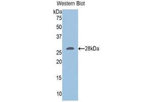 Western Blotting (WB) image for anti-Ubiquitin Hydrolase L3 (AA 2-230) antibody (ABIN1078639) (Ubiquitin Hydrolase L3 (AA 2-230) 抗体)