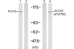 Western blot analysis of extracts from A431 cells, untreated or treated with EGF (200ng/ml, 5min), using PLCγ2 (Ab-753) antibody (E021186, Lane 1 and 2) and PLCγ2 (phospho-Tyr753) antibody (E011175, Lane 3 and 4). (Phospholipase C gamma 2 抗体)