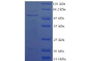 SDS-PAGE (SDS) image for Complement Component C4b (C4b) (AA 1454-1744) protein (His-SUMO Tag) (ABIN5710718) (C4B Protein (AA 1454-1744) (His-SUMO Tag))