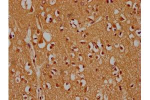 IHC image of ABIN7159994 diluted at 1:300 and staining in paraffin-embedded human brain tissue performed on a Leica BondTM system. (MAPK14 抗体  (AA 2-258))