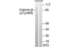 Western Blotting (WB) image for anti-Catenin, beta (CATNB) (pTyr489) antibody (ABIN1847544) (beta Catenin 抗体  (pTyr489))