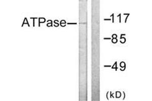 Western blot analysis of extracts from 293 cells, treated with PMA 125ng/ml 30', using ATPase (Ab-16) Antibody. (ATPase 抗体  (AA 5-54))