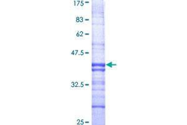 RABGAP1 Protein (AA 1-110) (GST tag)