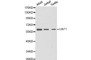 Western blot analysis of extracts of various cell lines, using UAP1 antibody. (UAP1 抗体  (AA 1-290))