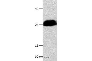 Western blot analysis of Huamn cervical cancer tissue , using BCL2L1 Polyclonal Antibody at dilution of 1:300 (BCL2L1 抗体)