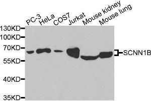 Western blot analysis of extracts of various cells, using SCNN1B antibody. (SCNN1B 抗体)
