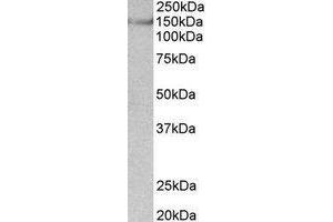 Western Blotting (WB) image for anti-Synaptic Ras GTPase Activating Protein 1 (SYNGAP1) (Internal Region) antibody (ABIN2464964) (SYNGAP1 抗体  (Internal Region))