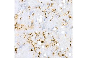 Immunohistochemistry of paraffin-embedded Rat brain using /IB antibody (ABIN7265554) at dilution of 1:100 (40x lens). (Iba1 抗体)