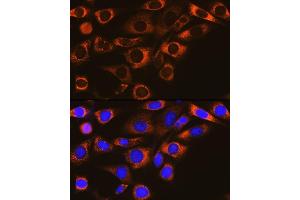 Immunofluorescence analysis of NIH-3T3 cells using F Rabbit mAb (ABIN1682600, ABIN3018533, ABIN3018534 and ABIN7101623) at dilution of 1:100 (40x lens). (FAAH 抗体)