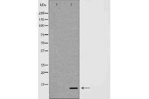 Western blot analysis of Hela whole cell lysates, using GLRX Antibody. (Glutaredoxin 1 抗体  (N-Term))