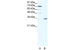 Western Blot showing MAGEA9 antibody used at a concentration of 1-2 ug/ml to detect its target protein. (MAGEA9 抗体  (N-Term))