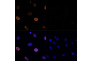 Immunofluorescence analysis of C6 cells using Acetyl-Histone H3-K56 Rabbit pAb (ABIN7267674) at dilution of 100 (40x lens). (Histone 3 抗体  (H3K56))