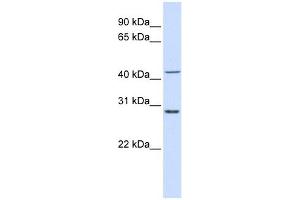 RPL3 antibody used at 1 ug/ml to detect target protein. (RPL3 抗体  (N-Term))