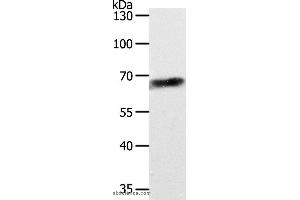 Western blot analysis of Jurkat cell, using ABCD4 Polyclonal Antibody at dilution of 1:700 (ABCD4 抗体)