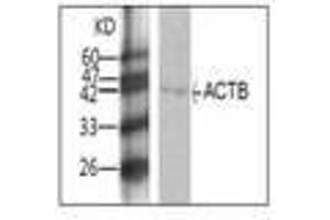 Image no. 1 for anti-Actin, beta (ACTB) antibody (ABIN791504) (beta Actin 抗体)