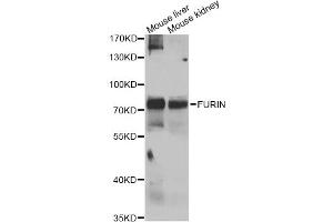 Western blot analysis of extracts of various cell lines, using FURIN antibody (ABIN4903706) at 1:1000 dilution. (FURIN 抗体)