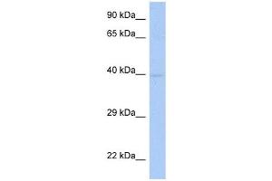 SDF4 antibody used at 1 ug/ml to detect target protein. (SDF4 抗体  (Middle Region))