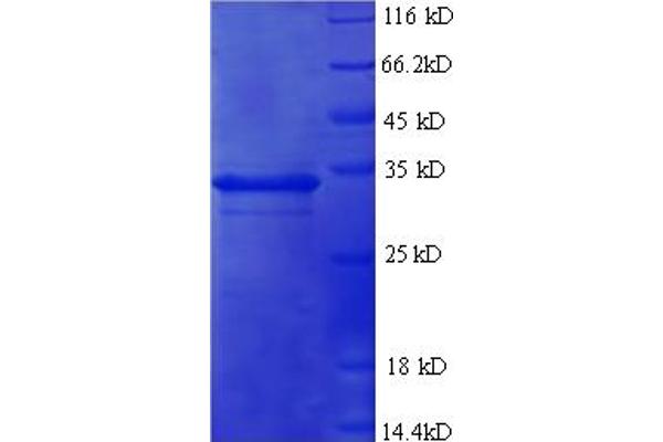 TNFAIP6 Protein (AA 18-277) (His tag)